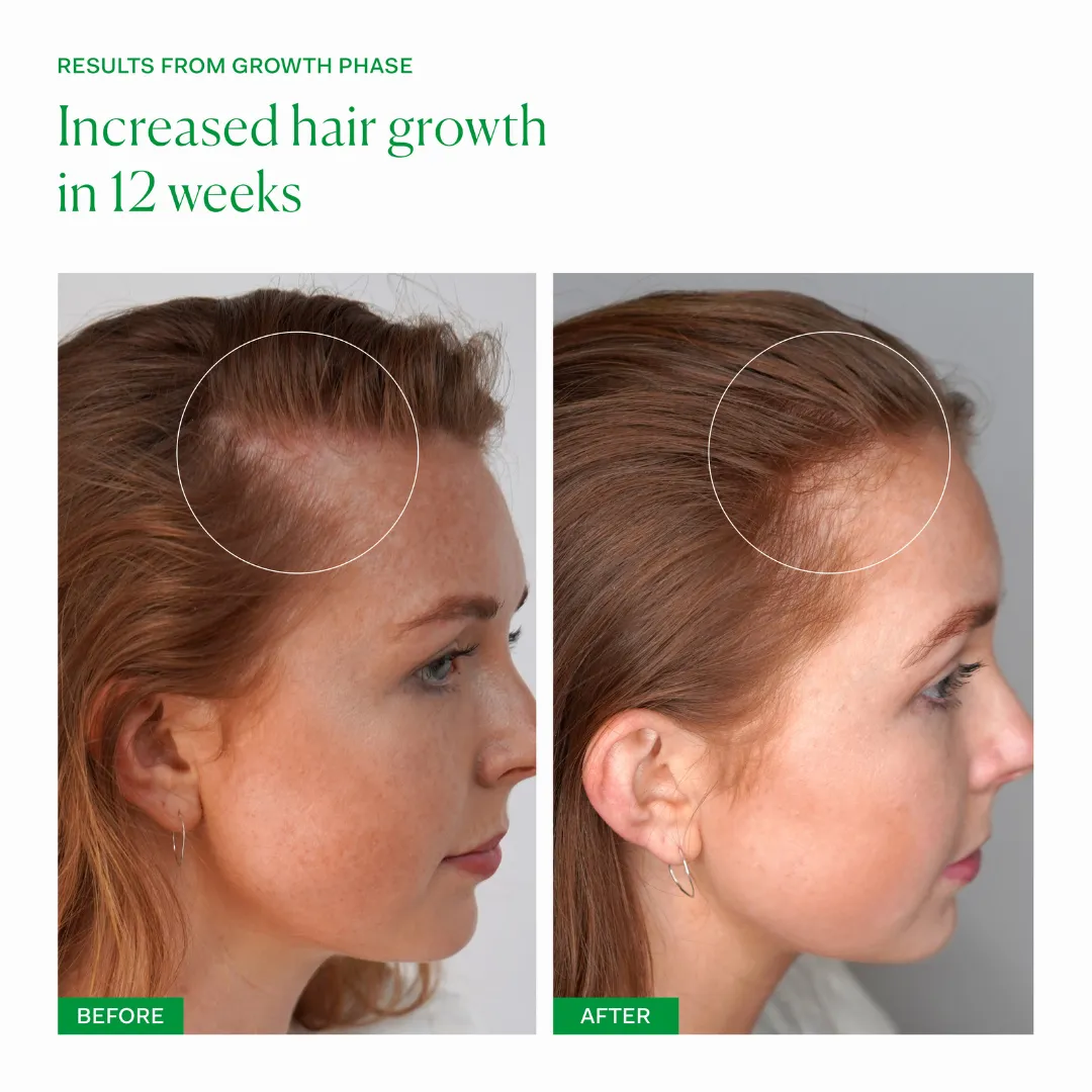 Growth Phase - Image 2
