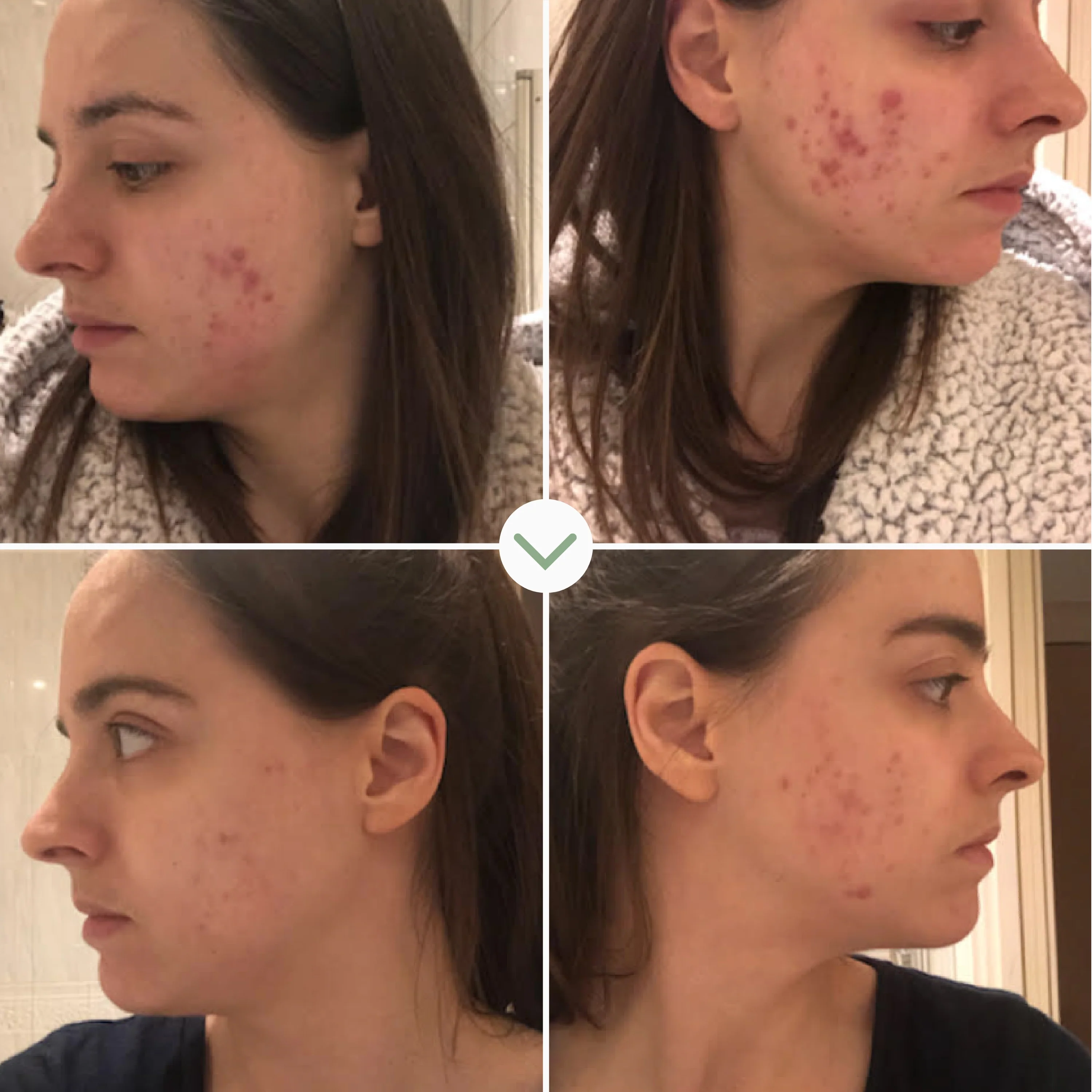 Instant Kalmer Ceramide Serum - Image 4