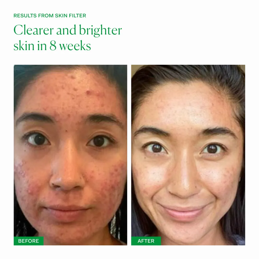 Skin Filter - Image 2